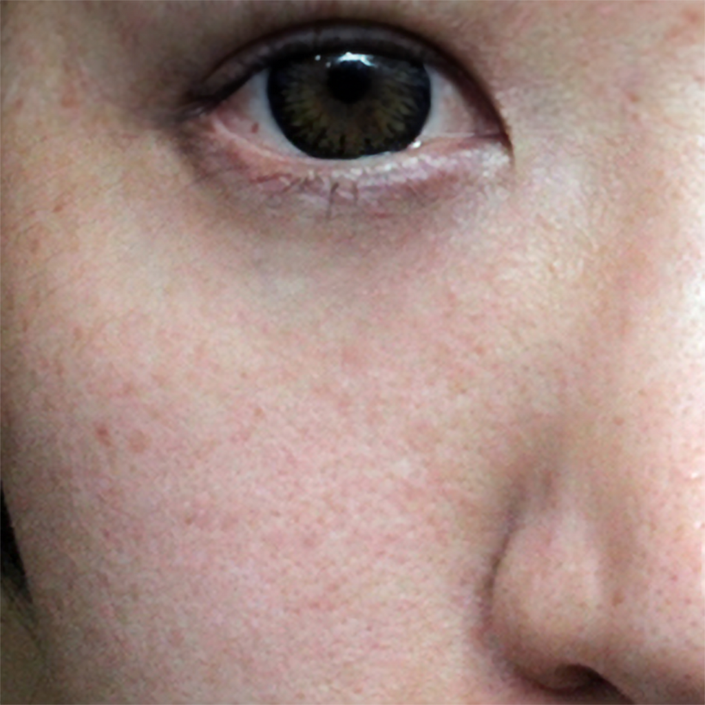 Close-up view of the left side of a person's face, featuring one eye with minimal dark circles, partial nose, and visible skin texture with some freckles, enhanced by the use of the TIMELESS ELIXIR Anti-Aging Eye Skincare Kit by IREN Shizen.